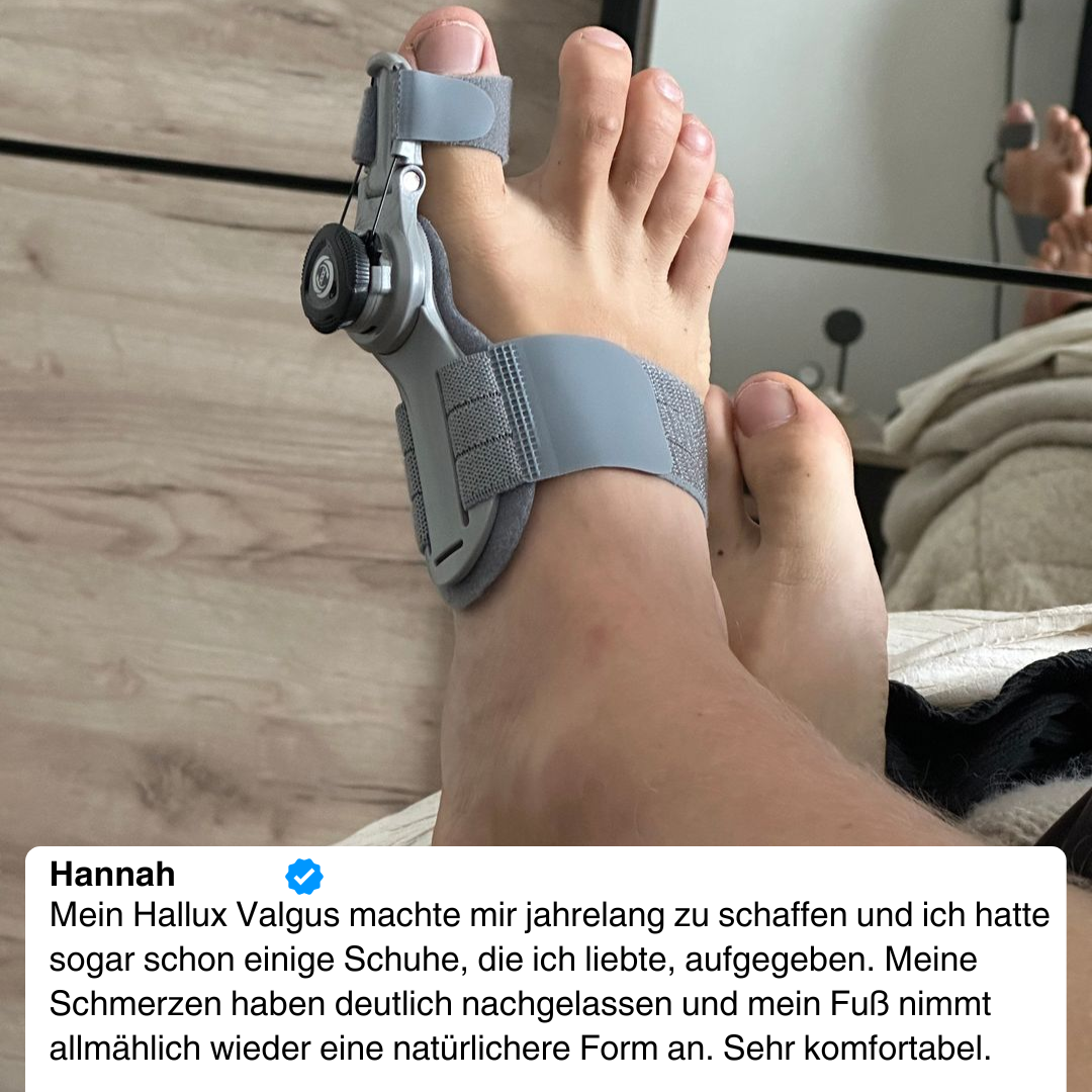 Hallux Valgus-Korrektur