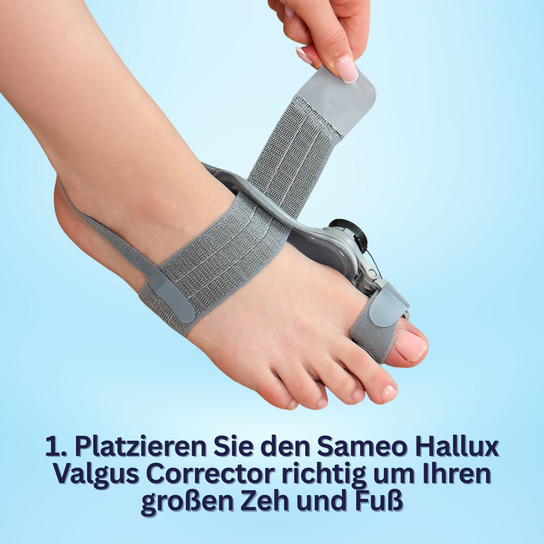 Hallux Valgus-Korrektur